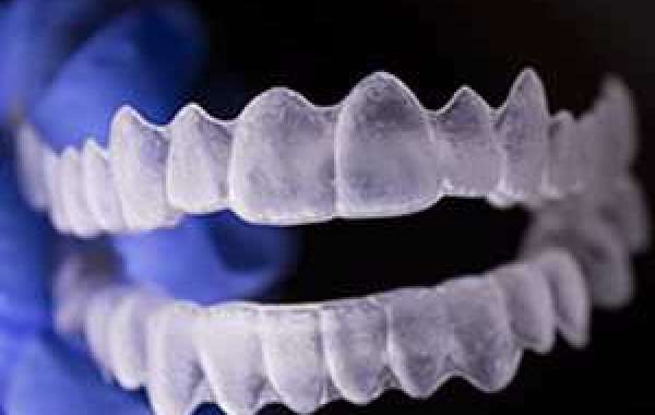 Are You Anxious About Your Pearly Whites Problems?