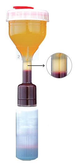 Regenerative Medicine Product