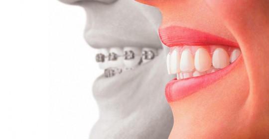 Steps to Look for the Reputable Dentist!