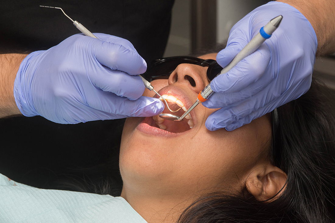Is Dental Bonding A Key To More Attractive Smile? - Midtown-Dental.over-blog.com