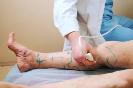 Coolsculpting Treatment: A Look At The Innovative Non-Intrusive Fat Removal Approach - evolutionmedspa