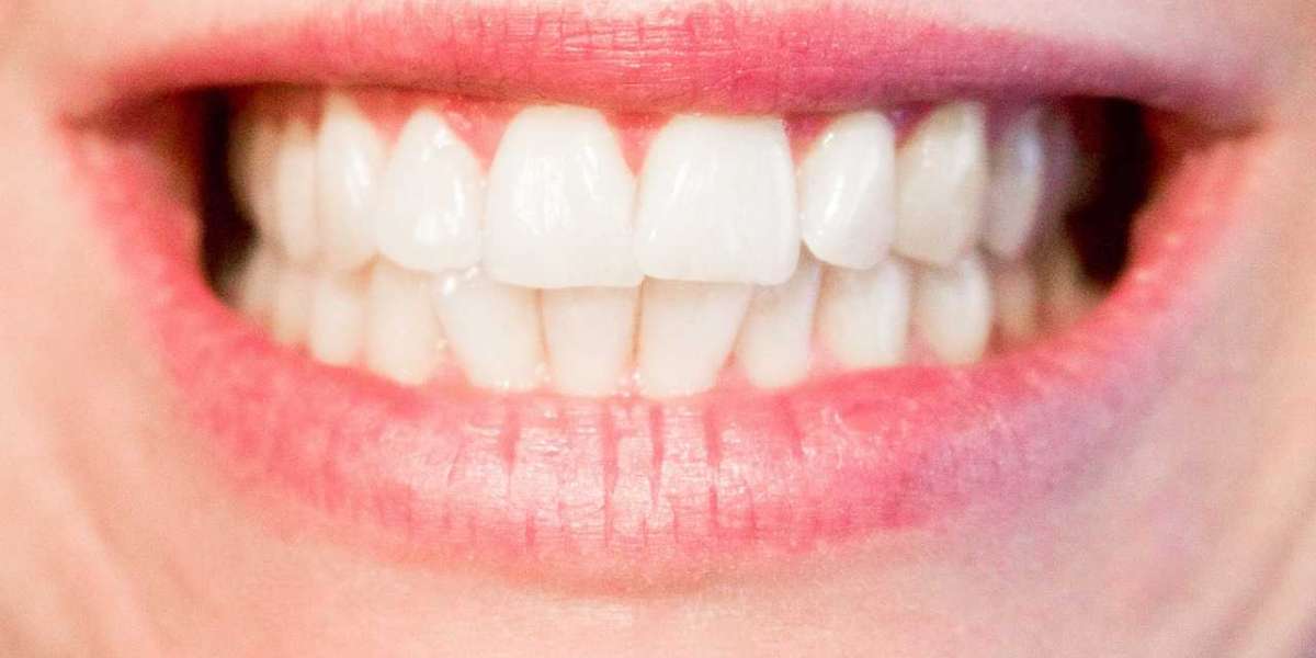 How To Prepare Yourself For A Meeting Your Dentist?