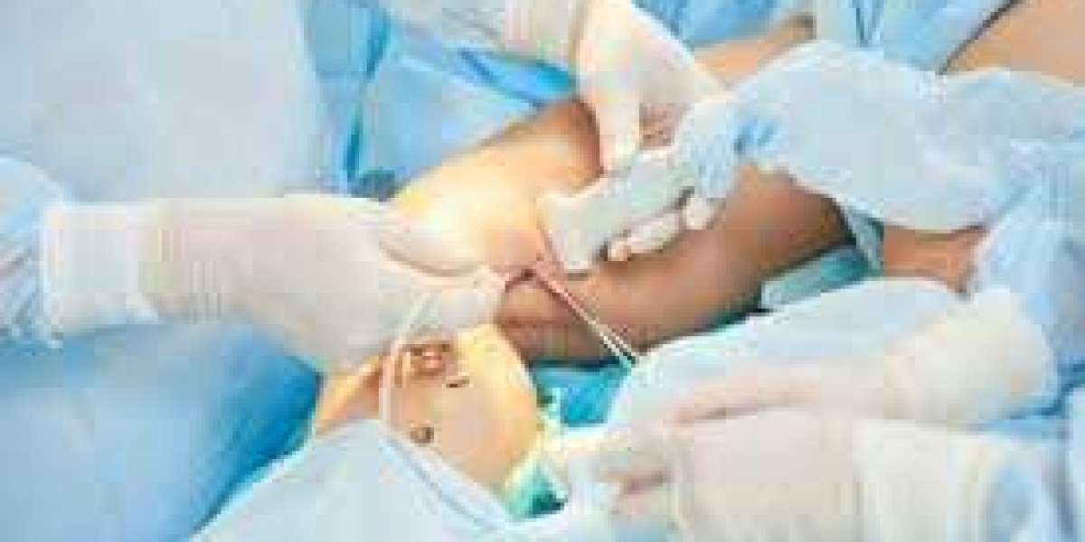 What can you expect from a vein treatment center