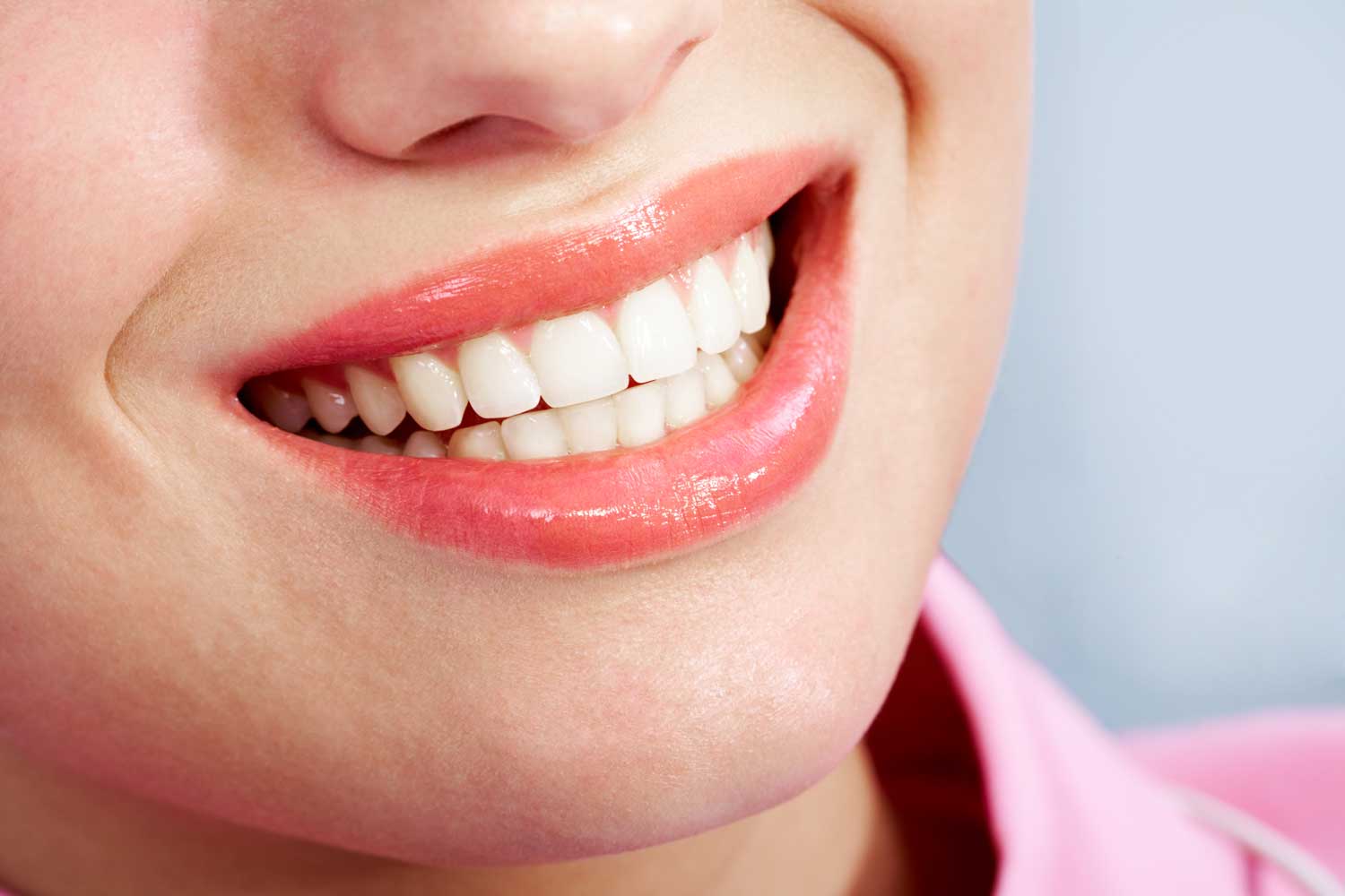 What are the different types of veneers according to Cosmetic Dentistry?