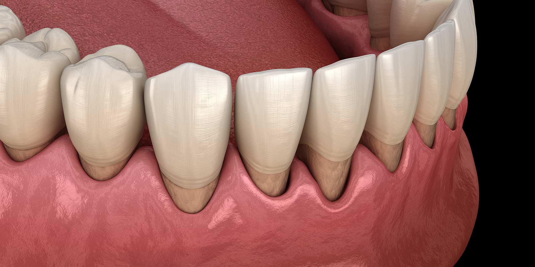 Does Your Gum Bleeds? Consult Periodontist Today - Find A Best And Perfect Clinic As Per Your Requirements : powered by Doodlekit