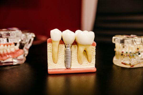 5 Ways To Find The Best Local Dentist