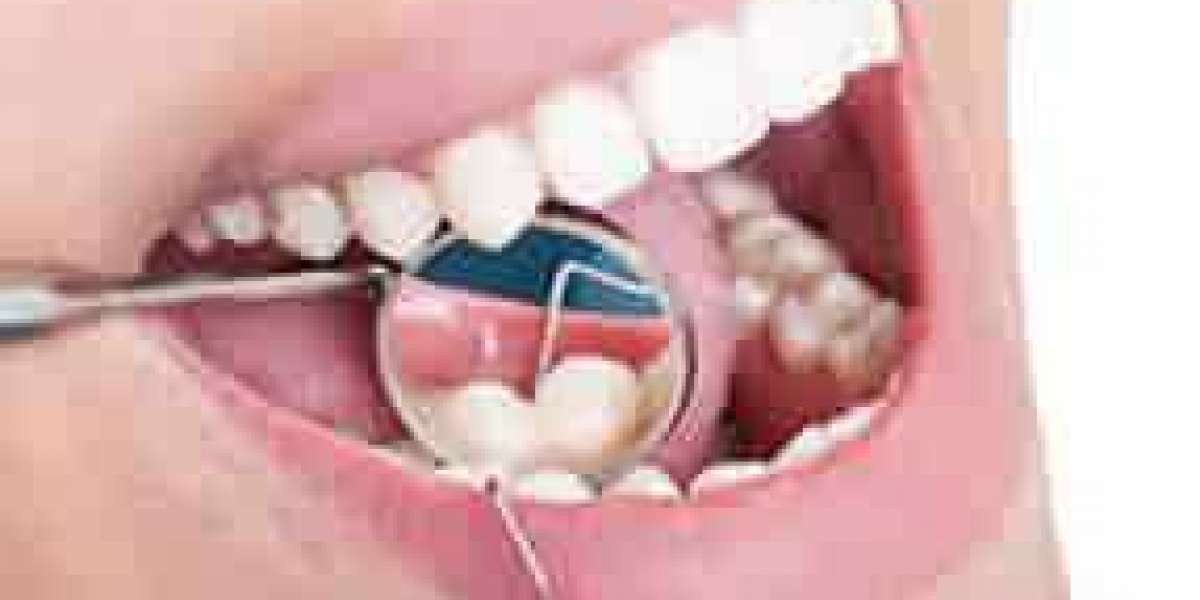 Best Dental Experts in Gurgaon-Haryana