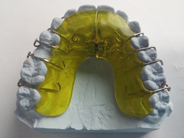 Miami Shores Orthodontist | Invisalign & Braces Shores, FL – Ivanov orthodontics
