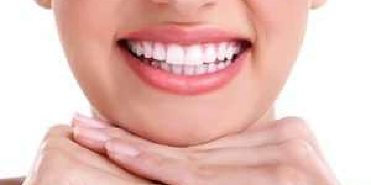 Teeth Whitening in Delhi
